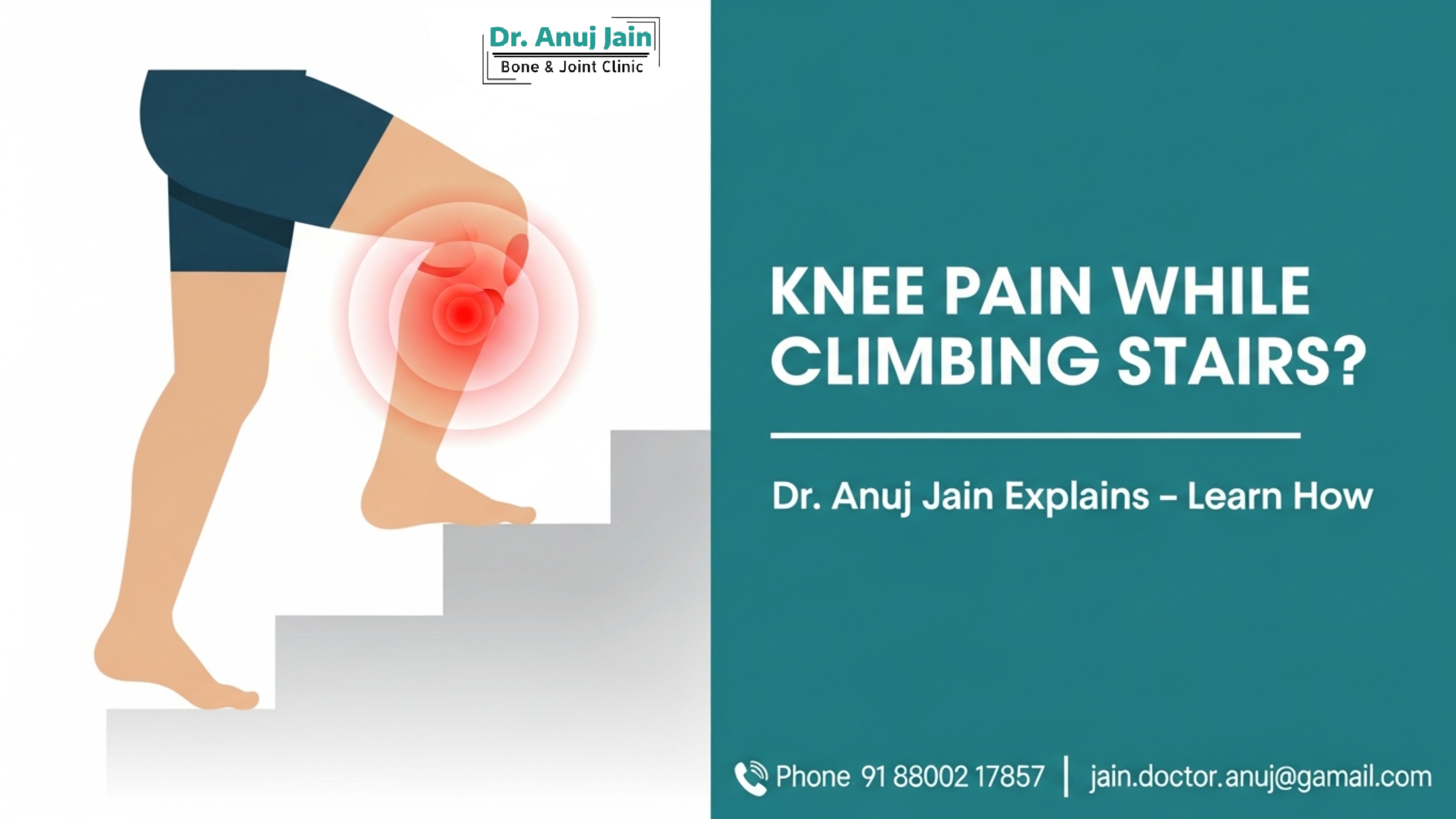 knee pain while climbing stairs

